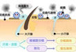 腋臭怎么治